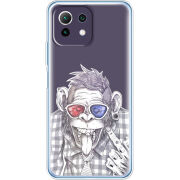 Чехол BoxFace Xiaomi Mi 11 Lite 