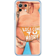 Чехол BoxFace Xiaomi Mi 11 Lite 