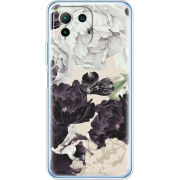 Чехол BoxFace Xiaomi Mi 11 Lite 