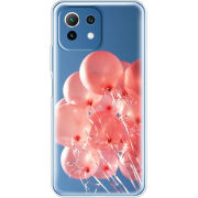 Чехол BoxFace Xiaomi Mi 11 Lite 