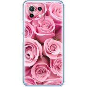 Чехол BoxFace Xiaomi Mi 11 Lite 