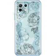 Чехол BoxFace Xiaomi Mi 11 Lite 