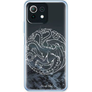 Чехол BoxFace Xiaomi Mi 11 Lite 