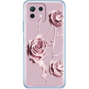 Чехол BoxFace Xiaomi Mi 11 Lite 