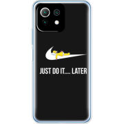 Чехол BoxFace Xiaomi Mi 11 Lite 