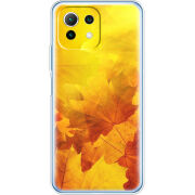 Чехол BoxFace Xiaomi Mi 11 Lite 