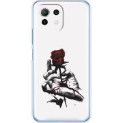 Чехол BoxFace Xiaomi Mi 11 Lite 