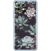 Чехол BoxFace Xiaomi Mi 11 Lite 