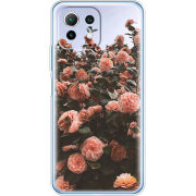 Чехол BoxFace Xiaomi Mi 11 Lite 