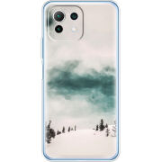 Чехол BoxFace Xiaomi Mi 11 Lite 