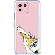 Чехол BoxFace Xiaomi Mi 11 Lite 