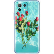 Чехол BoxFace Xiaomi Mi 11 Lite 