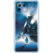 Чехол BoxFace Xiaomi Mi 11 Lite 