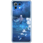 Чехол BoxFace Xiaomi Mi 11 Lite 