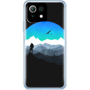 Чехол BoxFace Xiaomi Mi 11 Lite 