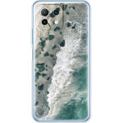 Чехол BoxFace Xiaomi Mi 11 Lite 