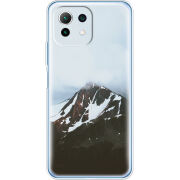 Чехол BoxFace Xiaomi Mi 11 Lite 