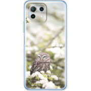 Чехол BoxFace Xiaomi Mi 11 Lite 