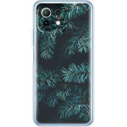 Чехол BoxFace Xiaomi Mi 11 Lite 