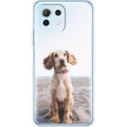 Чехол BoxFace Xiaomi Mi 11 Lite 