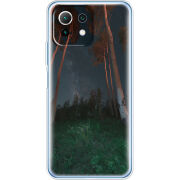 Чехол BoxFace Xiaomi Mi 11 Lite 