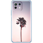 Чехол BoxFace Xiaomi Mi 11 Lite 