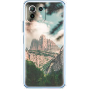 Чехол BoxFace Xiaomi Mi 11 Lite 