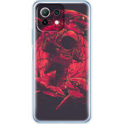 Чехол BoxFace Xiaomi Mi 11 Lite 