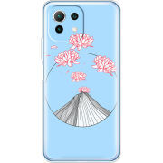 Чехол BoxFace Xiaomi Mi 11 Lite 