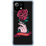 Чехол BoxFace Xiaomi Mi 11 Lite 