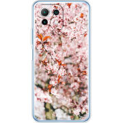 Чехол BoxFace Xiaomi Mi 11 Lite 