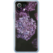 Чехол BoxFace Xiaomi Mi 11 Lite 