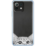 Чехол BoxFace Xiaomi Mi 11 Lite 