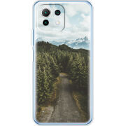 Чехол BoxFace Xiaomi Mi 11 Lite 