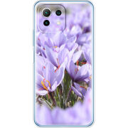 Чехол BoxFace Xiaomi Mi 11 Lite 