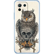 Чехол BoxFace Xiaomi Mi 11 Lite 