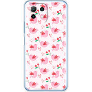 Чехол BoxFace Xiaomi Mi 11 Lite 