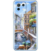 Чехол BoxFace Xiaomi Mi 11 Lite 