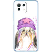 Чехол BoxFace Xiaomi Mi 11 Lite 