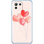 Чехол BoxFace Xiaomi Mi 11 Lite 