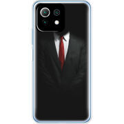 Чехол BoxFace Xiaomi Mi 11 Lite 