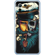 Чехол BoxFace Xiaomi Mi 11 Lite 