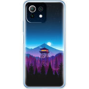 Чехол BoxFace Xiaomi Mi 11 Lite 