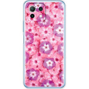 Чехол BoxFace Xiaomi Mi 11 Lite 