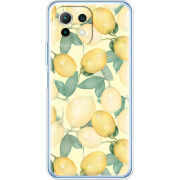 Чехол BoxFace Xiaomi Mi 11 Lite 