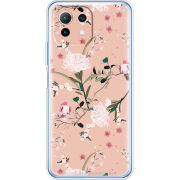 Чехол BoxFace Xiaomi Mi 11 Lite 