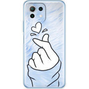 Чехол BoxFace Xiaomi Mi 11 Lite 