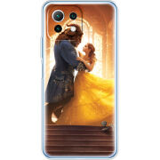 Чехол BoxFace Xiaomi Mi 11 Lite 