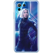 Чехол BoxFace Xiaomi Mi 11 Lite 