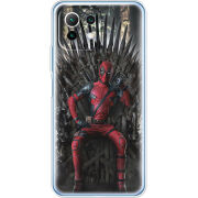 Чехол BoxFace Xiaomi Mi 11 Lite 